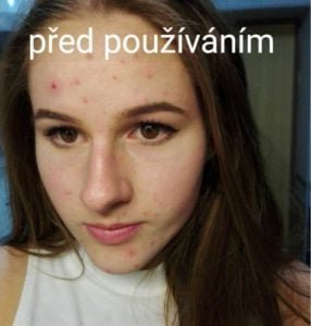 * Každý může mít individuální průběh