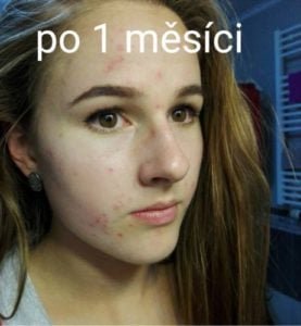 *Každý může mít individuální průběh