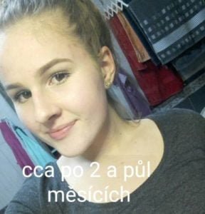 *Každý může mít individuální průběh