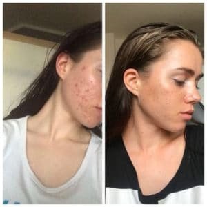 *Na každého produkty mohou působit individuálně a každý může mít jiný průběh a výsledek