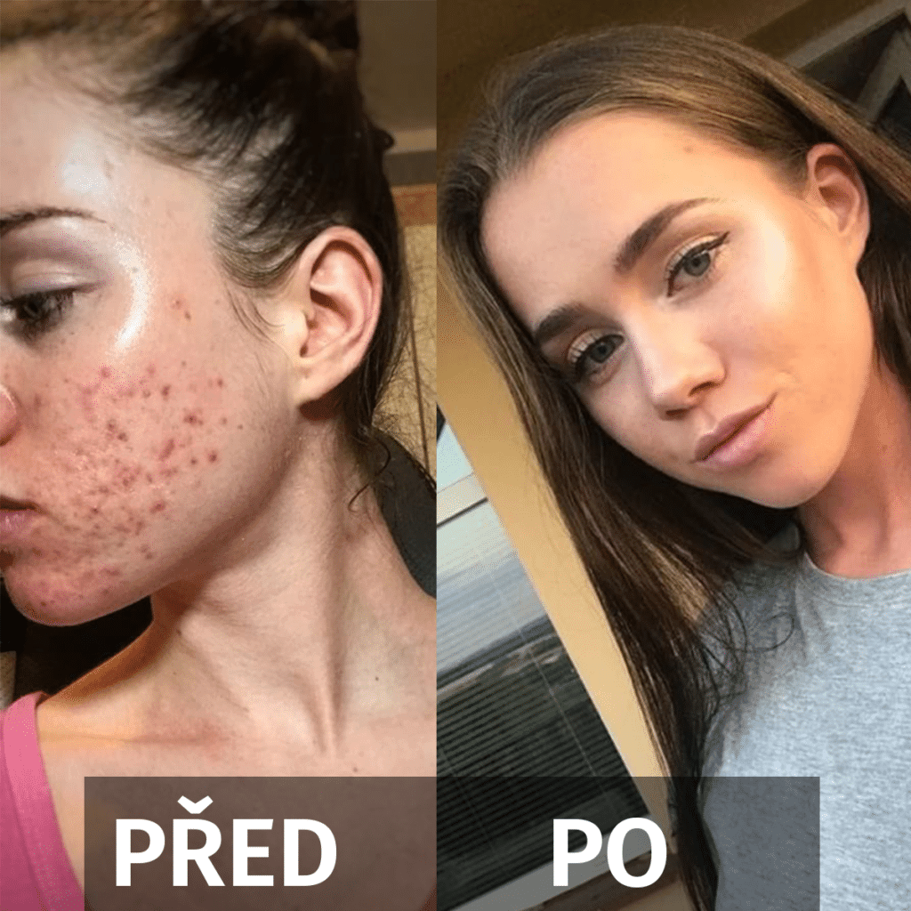 *Na každého produkty mohou působit individuálně a každý může mít jiný průběh a výsledek