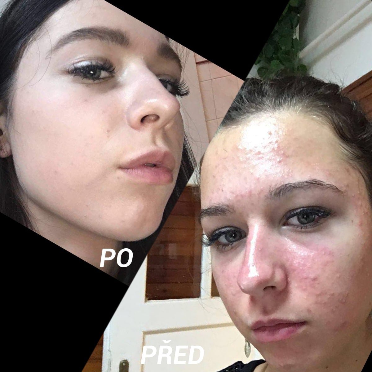 *Na každého produkty mohou působit individuálně a každý může mít jiný průběh a výsledek